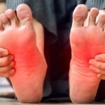 11 Home Remedies for Neuropathy